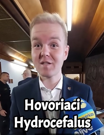 hovoriaca hlava